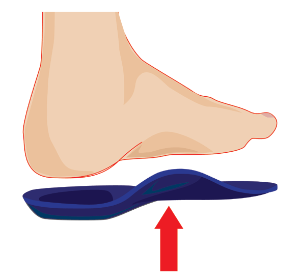 orthotic foot insoles